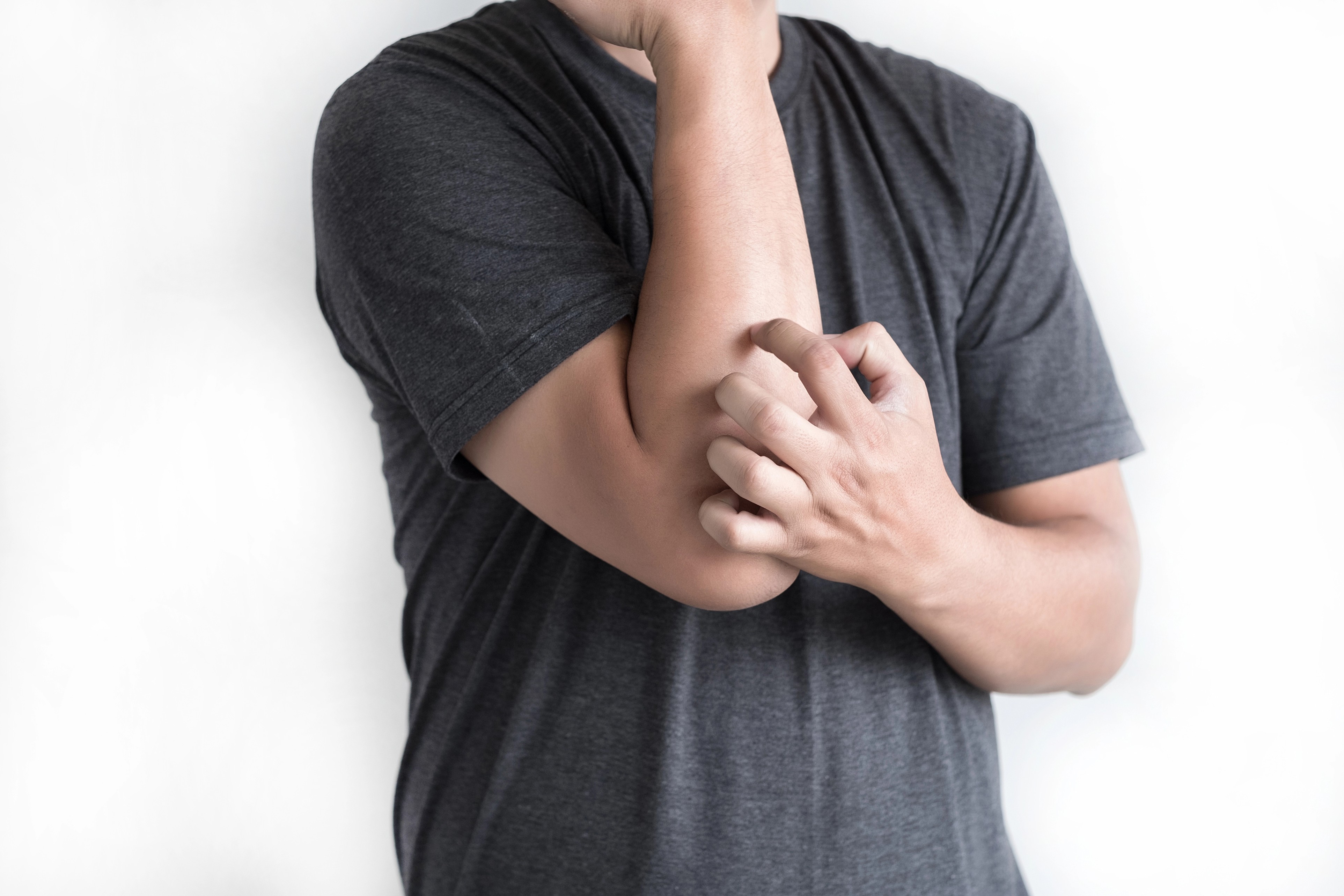 Calming the Itch: Evidence-Based Non-pharmacologic Interventions for Chronic Pruritus